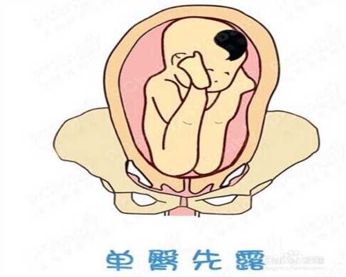 代孕初期同房出血怎么办_北京南威医院的助孕丸