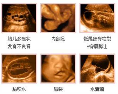 世纪助孕，中国试管代怀孕机构